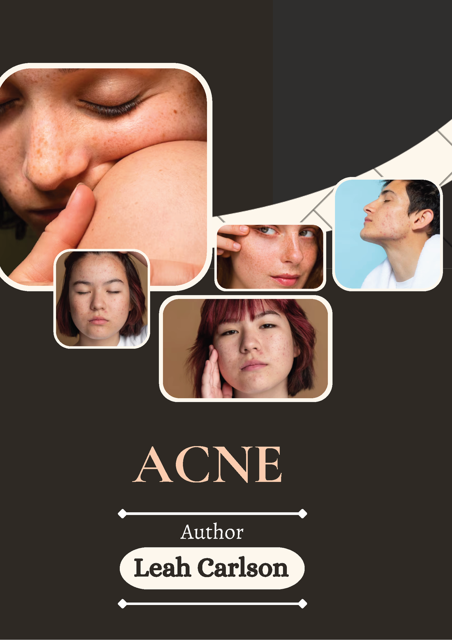 Acne Clearing E-book