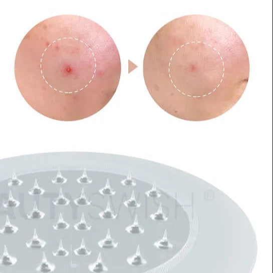 Needle Kiss patch (microneedling)